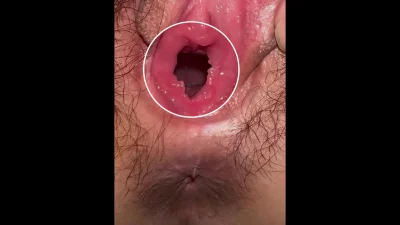 一眼看到宫颈
